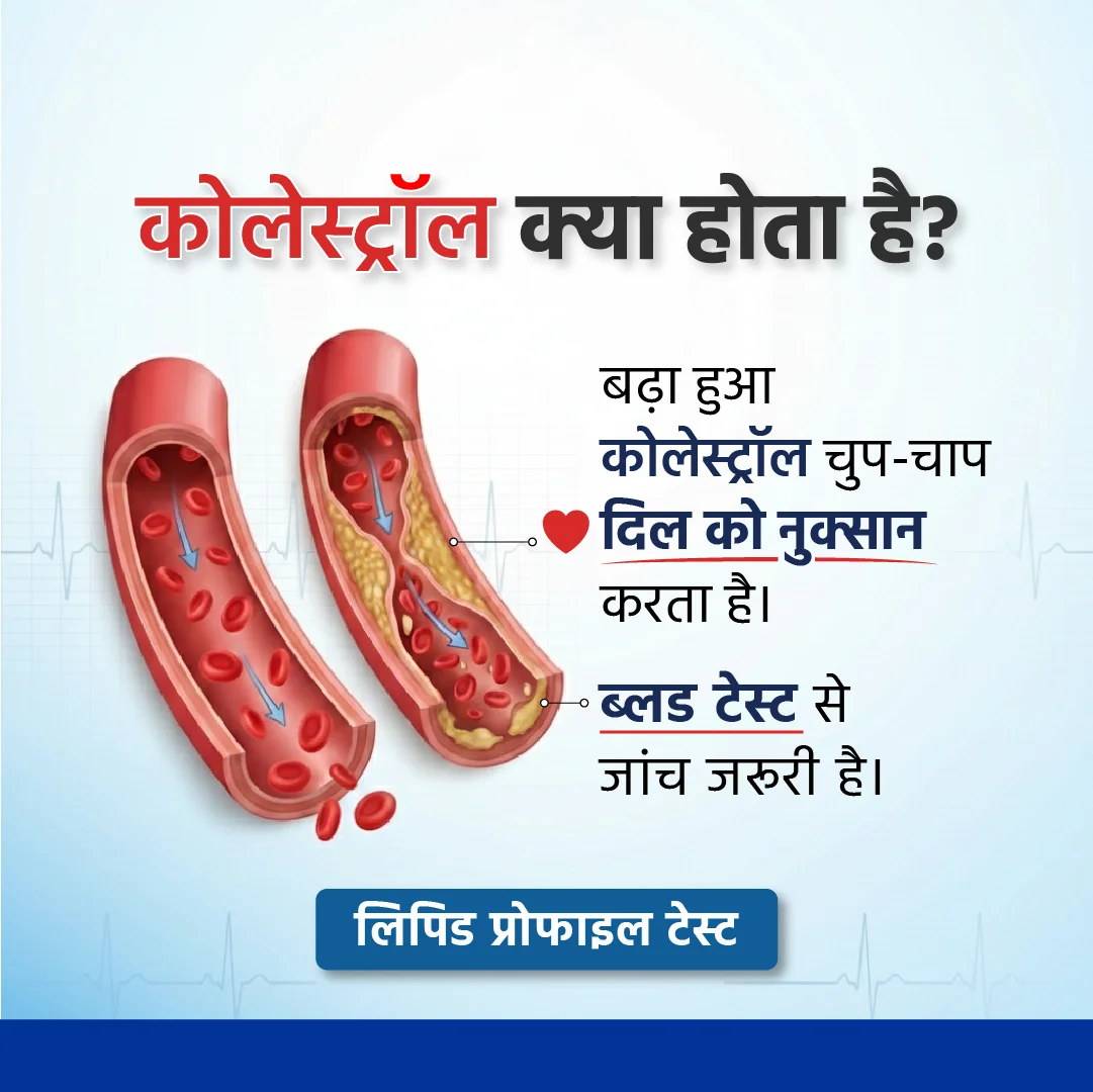Educational graphic on high blood pressure, displaying information in Hindi with relevant health icons and statistics.
